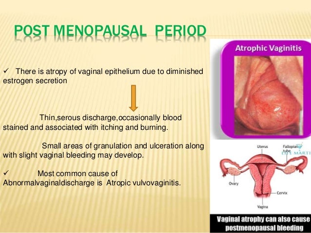 Vulva bacillus disease